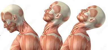 Cervical Extension