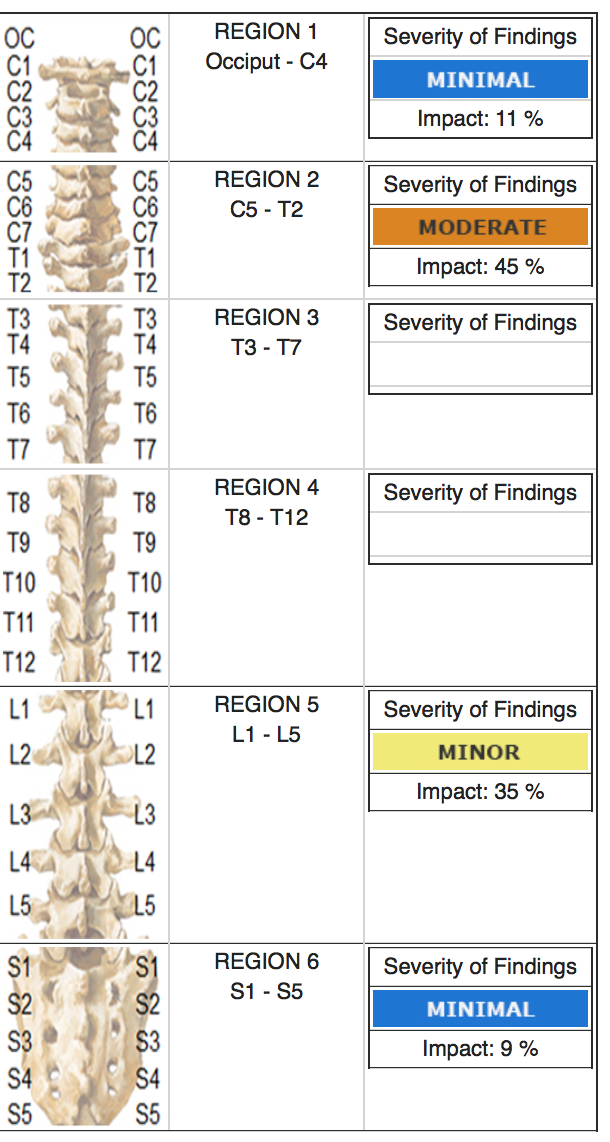 Spinal Impact Analysis